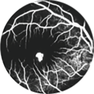 Logo Macula Society
